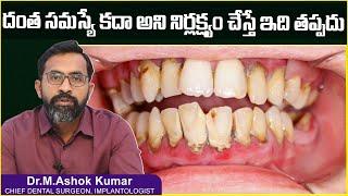 దంత సమస్య నిర్లక్ష్యం చేస్తే| Dental Care Tips in Telugu | Dr Ashok Kumar | Eledent Dental Hospitals