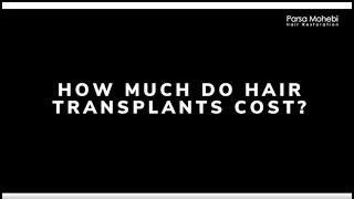 Cost of Hair Transplants