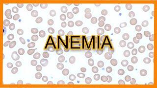 Anemia (Types, Findings, Lab Values)