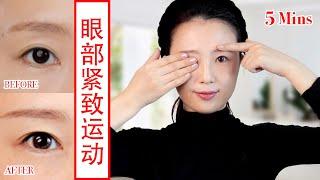 【How to tighten droopy eyelids】5 Mins Eye Exercises ，get rid of eye bags & dark circles