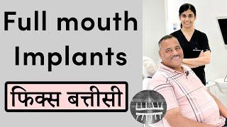 Full mouth Implant in India | Dental implant clinic in Indore | Seraphic Dental