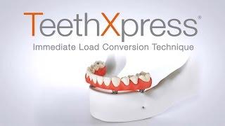 TeethXpress Immediate Temporization Animation