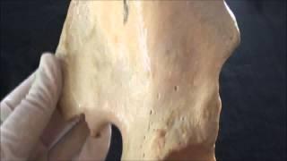 Hip bone anatomy - Part 2. - The Ilium