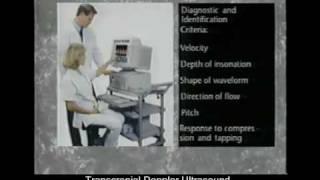 Transcranial Doppler Ultrasound Part 1.mp4