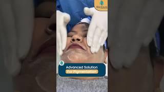 Nomelan Peel | Advanced solution for pigmentation | #shorts #skinqure