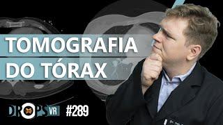 TOMOGRAFIA DO TÓRAX - SAIBA O BÁSICO!