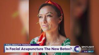 Is Facial Acupuncture The New Botox?