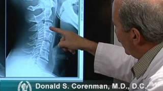 How to Read X-rays of the Cervical Spine (Neck) | Colorado Spine Expert