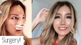 I got Plastic Surgery in Korea! ID Hospital | PART 1