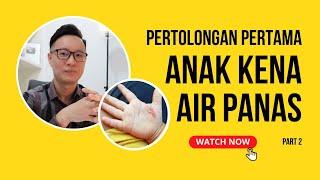 PERTOLONGAN PERTAMA ANAK TERSIRAM AIR PANAS | PART 2