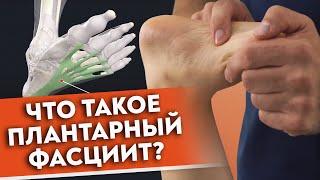 Болит пятка — что делать? | Плантарный фасциит: причины заболевания и срочная самопомощь