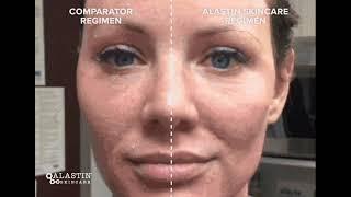 Alastin Skincare Banner Ad 4 (748x527) | Base Beauty Creative Agency