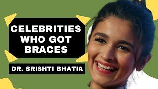 Celebrities who got Braces! Dr. Srishti Bhatia #braces #smile #smilemakeover