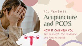 Vlog #11 Acupuncture and PCOS - symptoms and treatment strategies