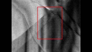 Phonon launch from step-edge in WSe2 (UEM)