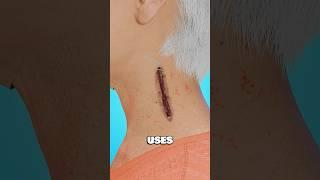 You Don’t Know How Stitches Actually Work…