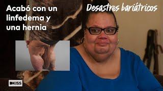 Tiene una masa gigante de más de 5kg entre las piernas | Desastres bariátricos