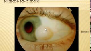 anterior segment images by an ophthalmologist