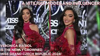 A VITILIGO MODEL & INFLUENCER VERONICA BIASIOL IS THE NEWLY CROWNED MISS GRAND CZECH REPUBLIC 2024!