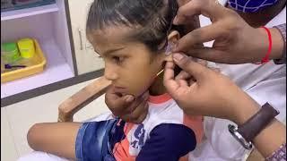 Hearing Aid in muzaffarpur, Child hearing for the first time, Pediatrics Audiology, Aud Himanshu