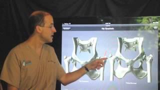 Femoral head and neck ostectomy (FHO) in the dog and cat.