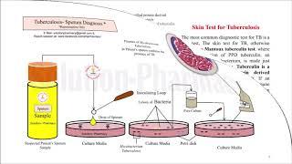 Tuberculosis Notes = B.Pharmacy 6th Semester | PDF is Available in Solution Pharmacy Mobile App