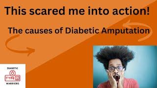 Diabetic Amputation: What are the real causes?