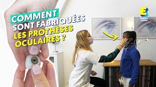 Comment sont fabriquées les prothèses oculaires ?