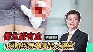 【名醫觀點】衛生紙有血、馬桶有血？台大醫師1招教你辨別痔瘡還是大腸癌