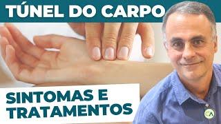 Síndrome do Túnel do Carpo - Sintomas e Tratamento