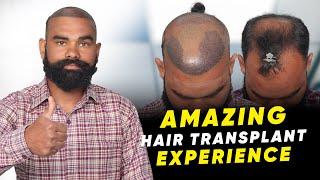 Hair Transplant in Kolkata | Best Results & Cost of Hair Transplant in Kolkata