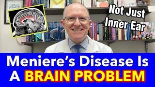 Why Meniere’s Disease Is a BRAIN Problem (not JUST balance, vertigo, hearing, tinnitus)