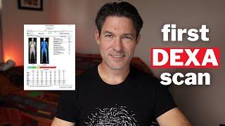 Why People Over 50 Should Get a DEXA Scan