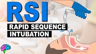 What is Rapid Sequence Intubation (RSI)?