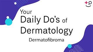 Dermatofibroma - Daily Do's of Dermatology