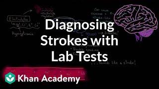 Diagnosing strokes with lab tests | Circulatory System and Disease | NCLEX-RN | Khan Academy