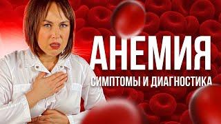 Анемия 🩸 Симптомы, причины, лечение Дефицит железа ДЖА