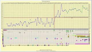 Pregnancy Chart, Long Cycles & Erratic Temperatures - FertilityFriend.com