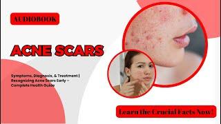 Acne Scars: Symptoms, Diagnosis, & Treatment | Recognizing Acne Scars Early – Complete Health Guide