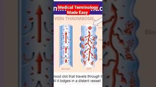 Medical Terminology Made Easy