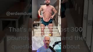 Loose skin after incredible weight loss!  (credit: @erdemdual on TikTok) #doctor #viral #trending