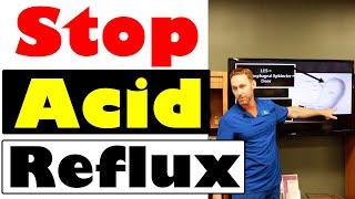 How to Stop Acid Reflux | Update 2022