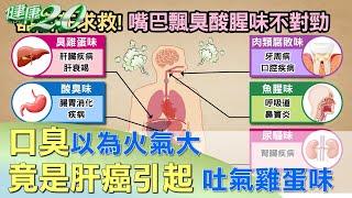 口臭以為火氣大 竟是肝癌引起 吐氣全臭雞蛋味 健康2.0