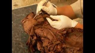 MNF Medad Team | Dr. Ayman Abdallah H&N Practical Anatomy [ Spotting 02 ]