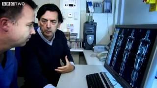 Jacques' MRI Scan - The Men Who Made Us Fat - Episode 1 - BBC