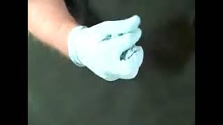 proper glove removal