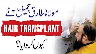 Maulana Tariq Jameel’s Hair Transplant - Qasim Ali Shah