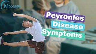 Peyronies Disease Symptoms