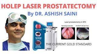 Laser prostate removal in Delhi NCR (HOLEP) - by Dr Ashish Saini