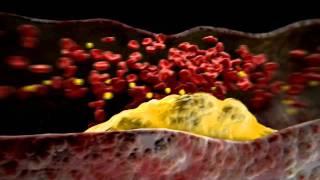 Medical Animation - Cardiovascular